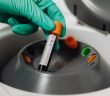 PRP Therapy for Erectile Dysfunction
